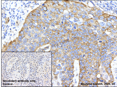 Anti-IGF2BP2/IMP-2 Rabbit mAb [84K59B64]