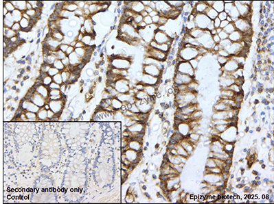 Anti-IGF2BP2/IMP-2 Rabbit mAb [84K59B64]