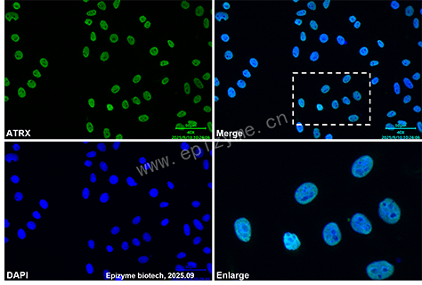 Anti-ATRX Rabbit mAb [11G45T02]