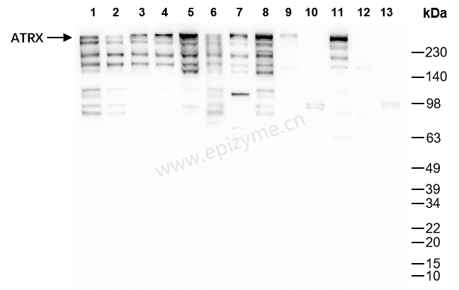 Anti-ATRX Rabbit mAb [11G45T02]