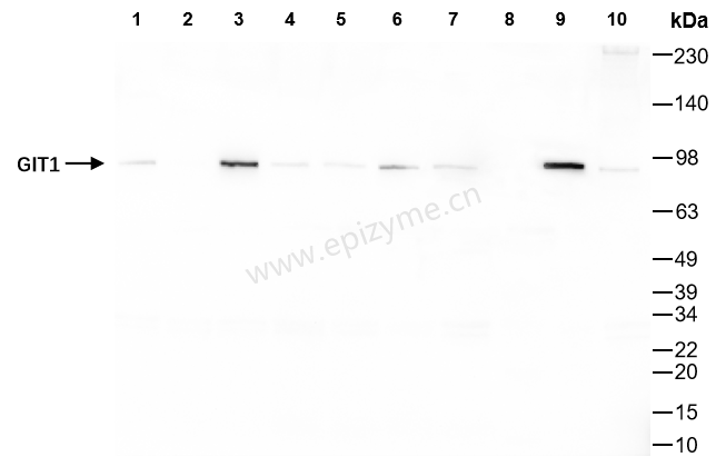 Anti-GIT1 Rabbit mAb [60A70M55]