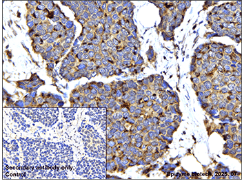 Anti-GIT1 Rabbit mAb [60A70M55]