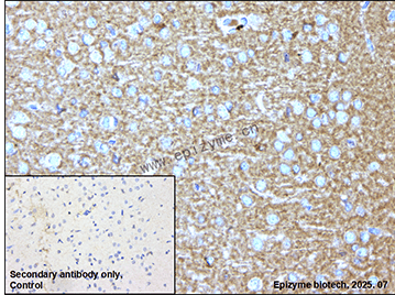 Anti-GABBR1 Rabbit mAb [64F61F06]