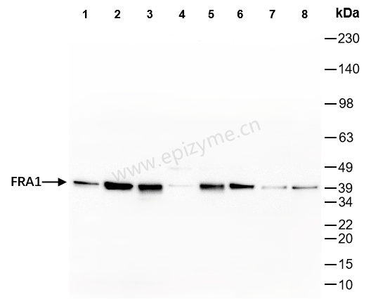 Anti-FOSL1 Rabbit mAb [79G08I77]