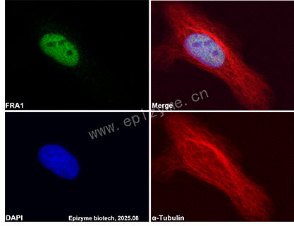 Anti-FOSL1 Rabbit mAb [79G08I77]