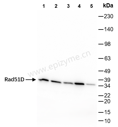 Anti-Rad51D Rabbit mAb [25F71H62]