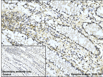 Anti-Rad51D Rabbit mAb [25F71H62]
