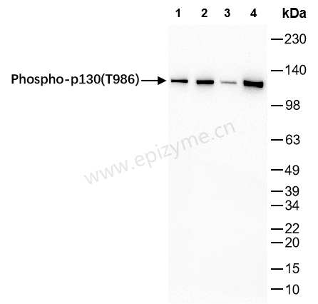 Anti-Phospho-Rb2/p130 (Thr986) Rabbit mAb [84A26Q35]