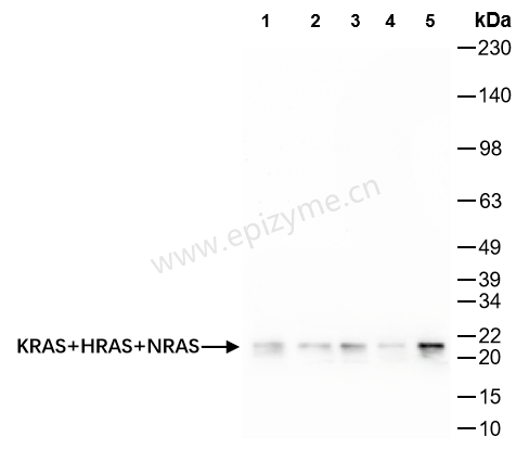 Anti-Ras Rabbit mAb [28P24A51]