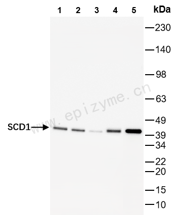 Anti-SCD1 Rabbit mAb [60L70M15]