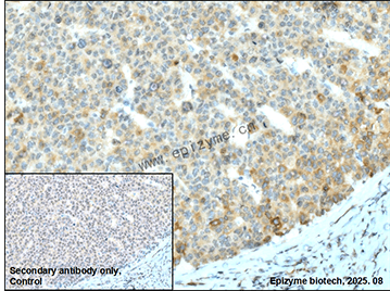 Anti-SCD1 Rabbit mAb [60L70M15]