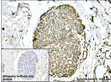 Anti-CDC42 Rabbit mAb [11L56M54]
