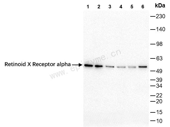 Anti-Retinoid X Receptor alpha Rabbit mAb [70L17K02]