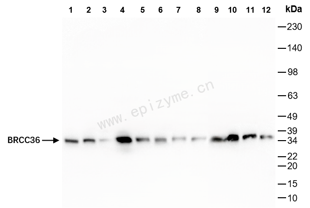 Anti-BRCC36 Rabbit mAb [92L85K61]