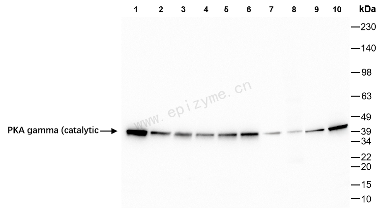 Anti-PKA gamma Rabbit mAb [22K47L81]