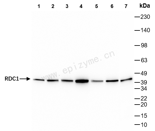 Anti-GPCR RDC1/CXCR-7 Rabbit mAb [93M04K62]