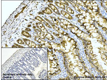 Anti-IDH1 Rabbit mAb [48K31L79]
