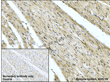 Anti-IDH1 Rabbit mAb [48K31L79]