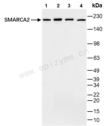 Anti-SMARCA2 Rabbit mAb [88K86M47]