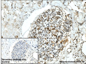 Anti-SMARCA2 Rabbit mAb [88K86M47]
