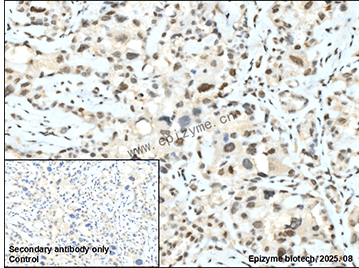 Anti-SMARCA2 Rabbit mAb [88K86M47]