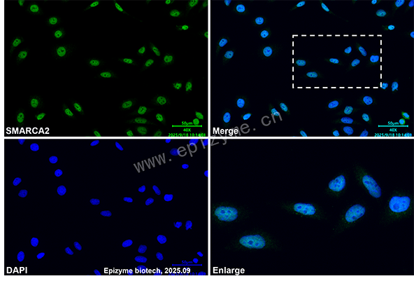 Anti-SMARCA2 Rabbit mAb [88K86M47]