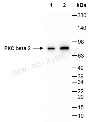 Anti-PKC beta 2 Rabbit mAb [23M90L27]