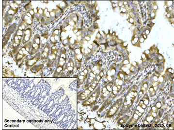 Anti-PKC beta 2 Rabbit mAb [23M90L27]