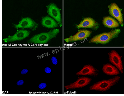 Anti-Acetyl Coenzyme A Carboxylase Rabbit mAb [92K41K44]