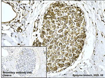 Anti-Acetyl Coenzyme A Carboxylase Rabbit mAb [92K41K44]