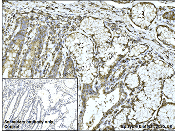 Anti-Acetyl Coenzyme A Carboxylase Rabbit mAb [92K41K44]
