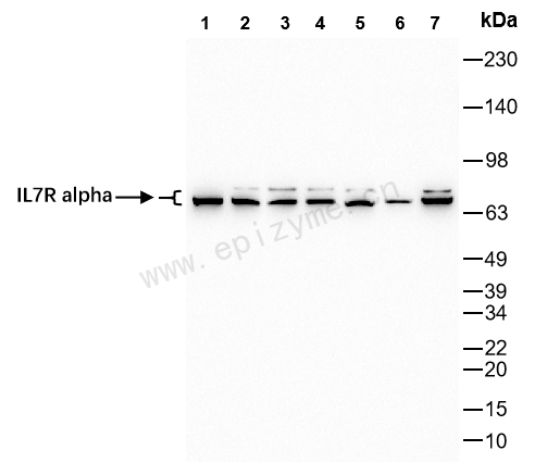 Anti-CD127 Rabbit mAb [15M52K63]