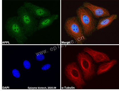 Anti-APPL Rabbit mAb [59L67K49]