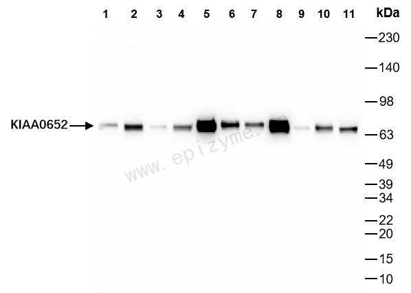 Anti-ATG13 Rabbit mAb [28L74L74]