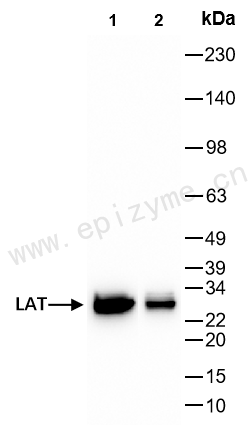 Anti-LAT Rabbit mAb [43L36K67]