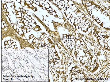 Anti-LAT Rabbit mAb [43L36K67]