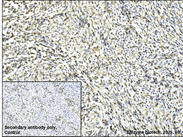 Anti-LAT Rabbit mAb [43L36K67]