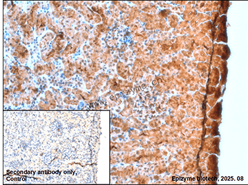 Anti-Superoxide Dismutase 1 Rabbit mAb [81M16M80]