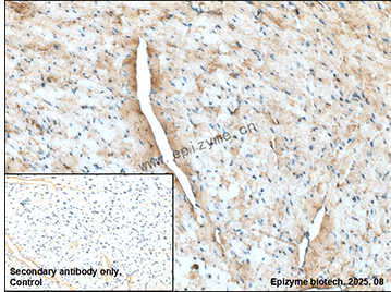 Anti-Superoxide Dismutase 1 Rabbit mAb [81M16M80]
