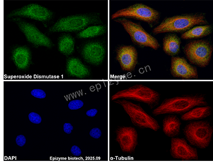 Anti-Superoxide Dismutase 1 Rabbit mAb [81M16M80]