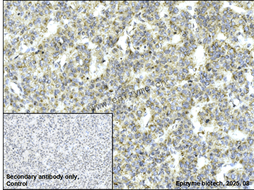 Anti-Alkyl-DHAP synthase Rabbit mAb [87M37L29]