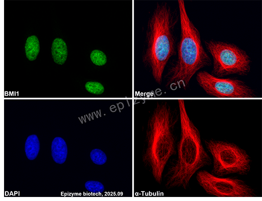 Anti-BMI1 Rabbit mAb [76M96L36]