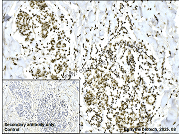 Anti-BMI1 Rabbit mAb [76M96L36]