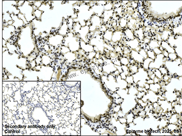 Anti-BMI1 Rabbit mAb [76M96L36]