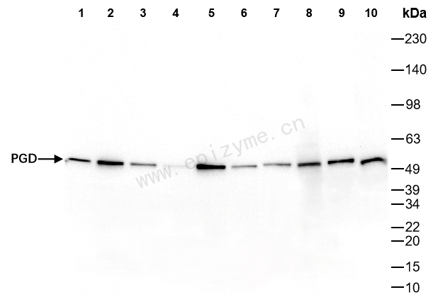 Anti-PGD Rabbit mAb [87M43L75]