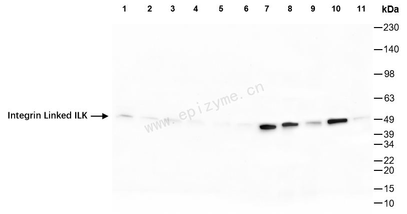 Anti-Integrin Linked ILK Rabbit mAb [80M02M00]