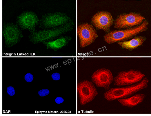 Anti-Integrin Linked ILK Rabbit mAb [80M02M00]