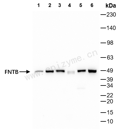 Anti-FNTB Rabbit mAb [50K99K66]