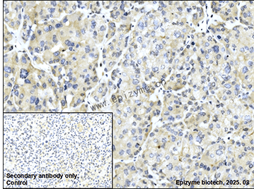 Anti-FNTB Rabbit mAb [50K99K66]