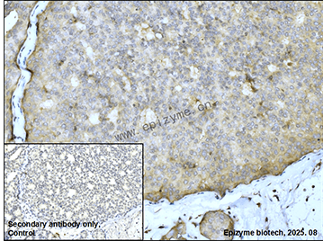 Anti-FNTB Rabbit mAb [50K99K66]